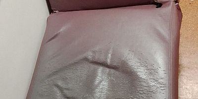 Refakatçi koltuklarının kırık oluşu hasta yakınlarını isyan ettiriyor!